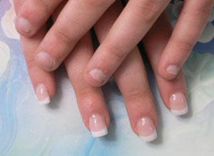 ongles-manucure-ongle-ronge-avant-apres.jpg